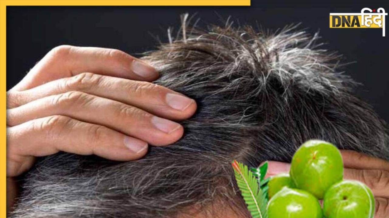 White Hair Remedy: बालों की सफेदी को दूर करेगा हरा आंवला, नहीं रहेगी मेहंदी लगाने की जरूरत