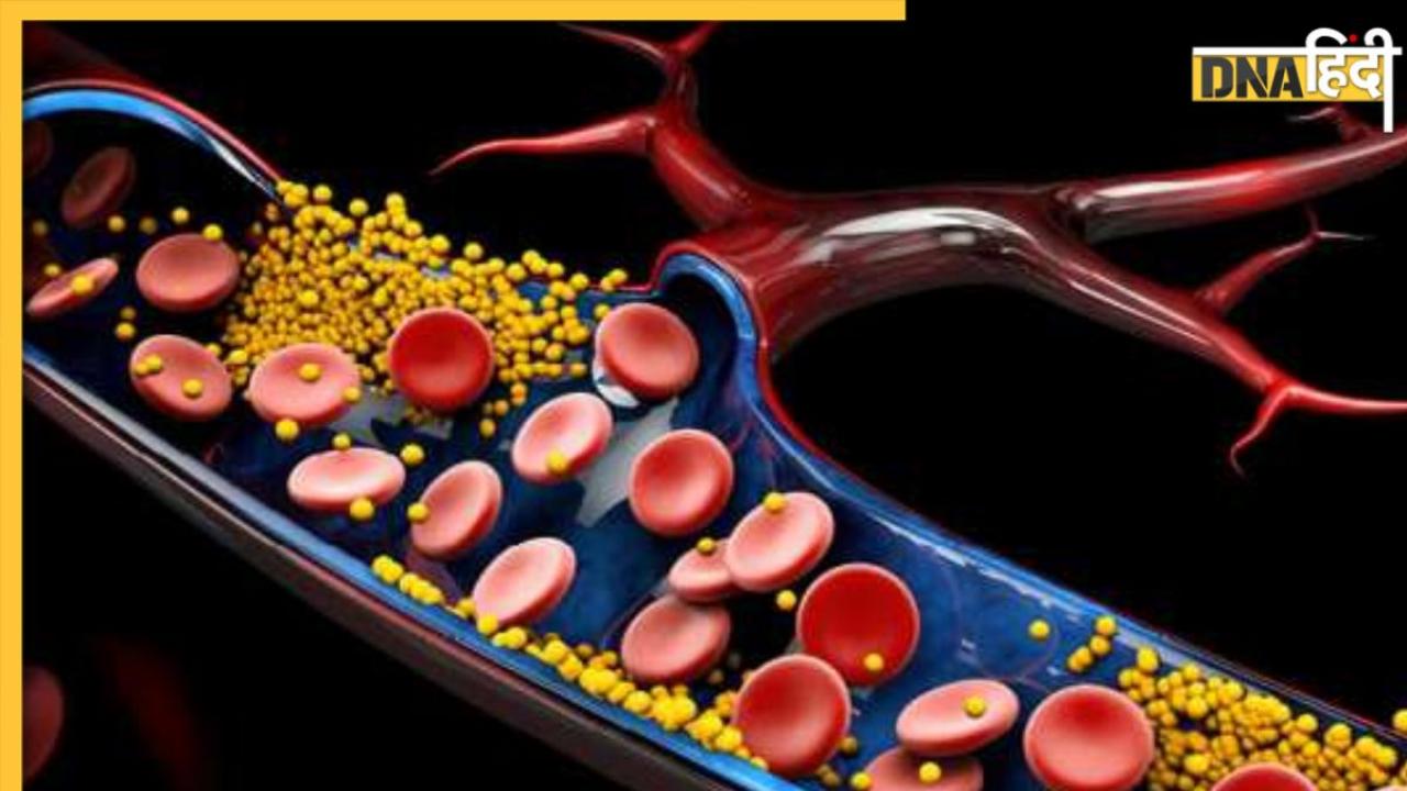 Cholesterol Remedy: नसों में जमा गंदे कोलेस्ट्रॉल को पानी बना बाहर कर देंगी ये 5 चीजें, डाइट में करें शामिल 