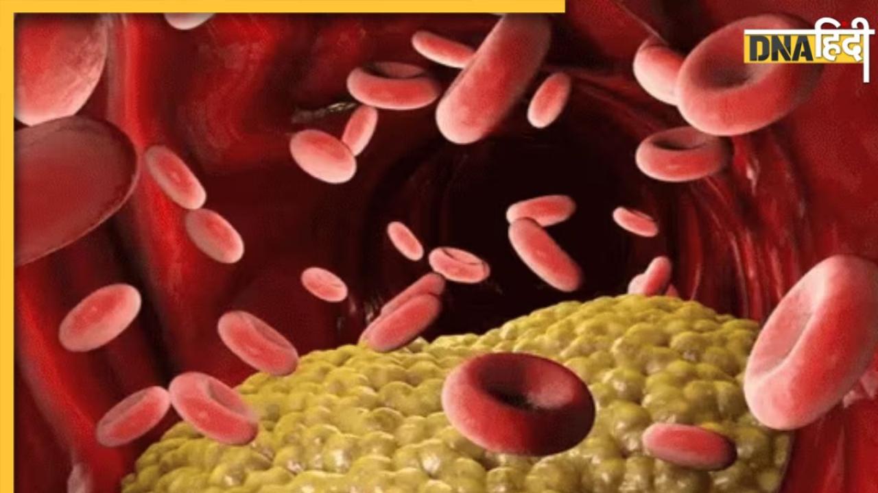 High Cholesterol Control: बिना दवा ही कम होगा हाई कोलेस्ट्रॉल, डेली रूटीन में फॉलो करें ये 5 टिप्स