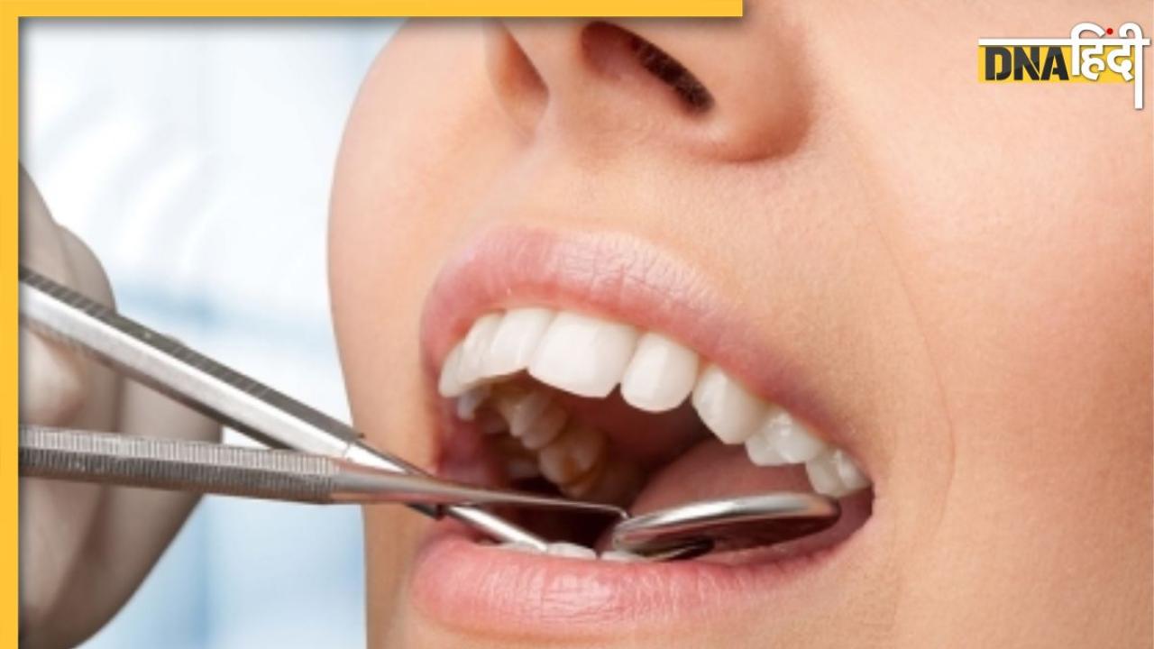 Teeth Cavity Remedies: दांतों में लगे कीड़ों को साफ कर देंगे ये घरेलू नुस्खें, अंदर तक साफ और सफेद हो जाएंगे एक-एक दांत