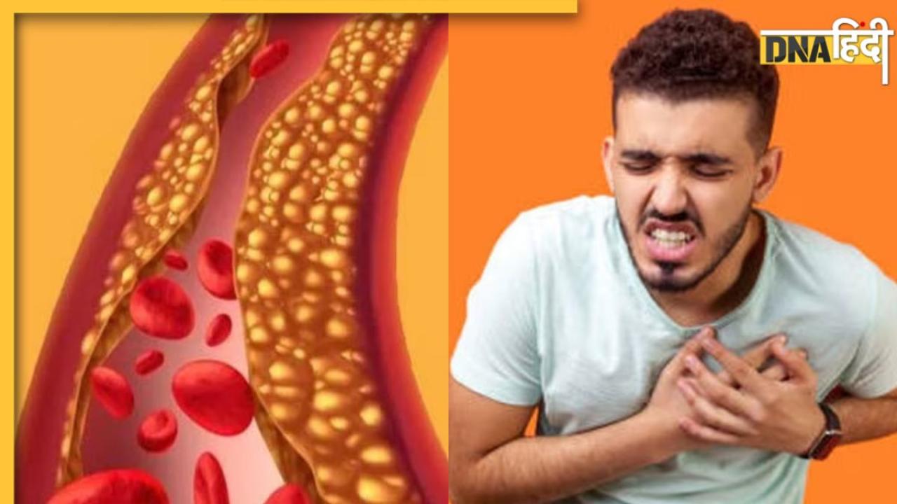 Cholesterol Remedy: नसों में जमा पीली गंदगी बाहर निकाल देंगी ये 5 चीजें, बासी मुंह खाएंगे तो फायदा होगा डबल
