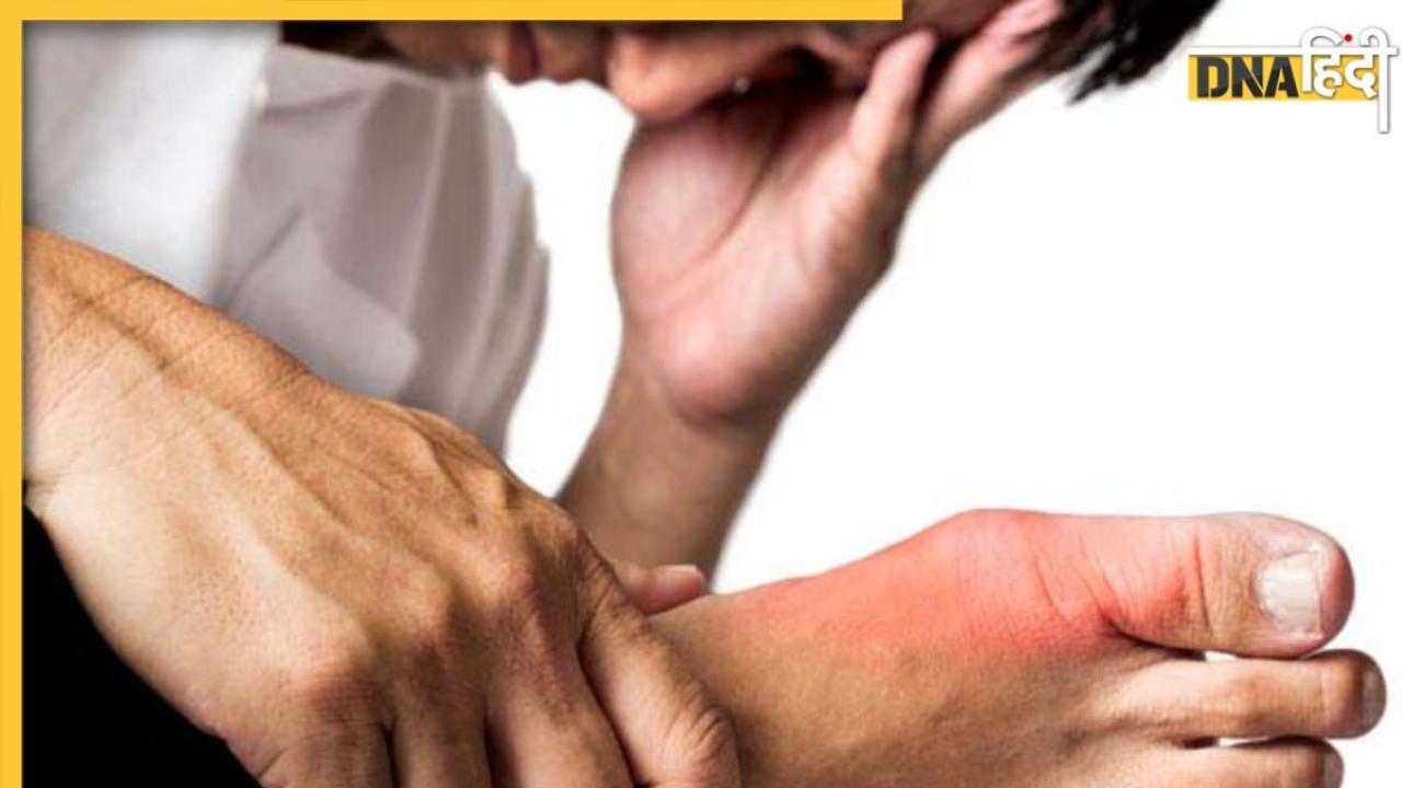 Control High Uric Acid: यूरिक एसिड को कंट्रोल में रखेंगी ये सब्जियां, दूर होगा जोड़ों का दर्द