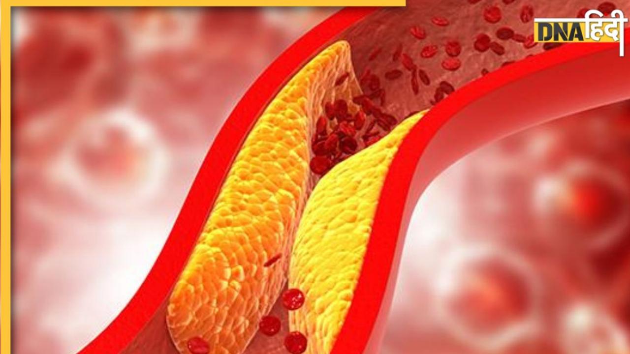 Cholesterol Remedy: नसों में जमा गंदा कोलेस्ट्रॉल पानी बना देंगे ये 6 फूड, बिना दवा ही कम होने लगेगी ब्लड में जमी वसा