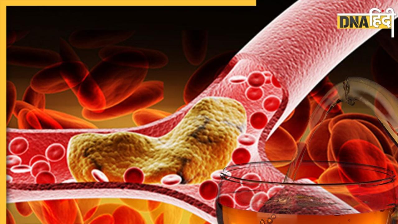 Cholesterol Control: इस पत्ते की चाय से हफ्तेभर में कम होगा गंदा कोलेस्ट्रॉल, खुल जाएगी नसों की ब्लॉकेज