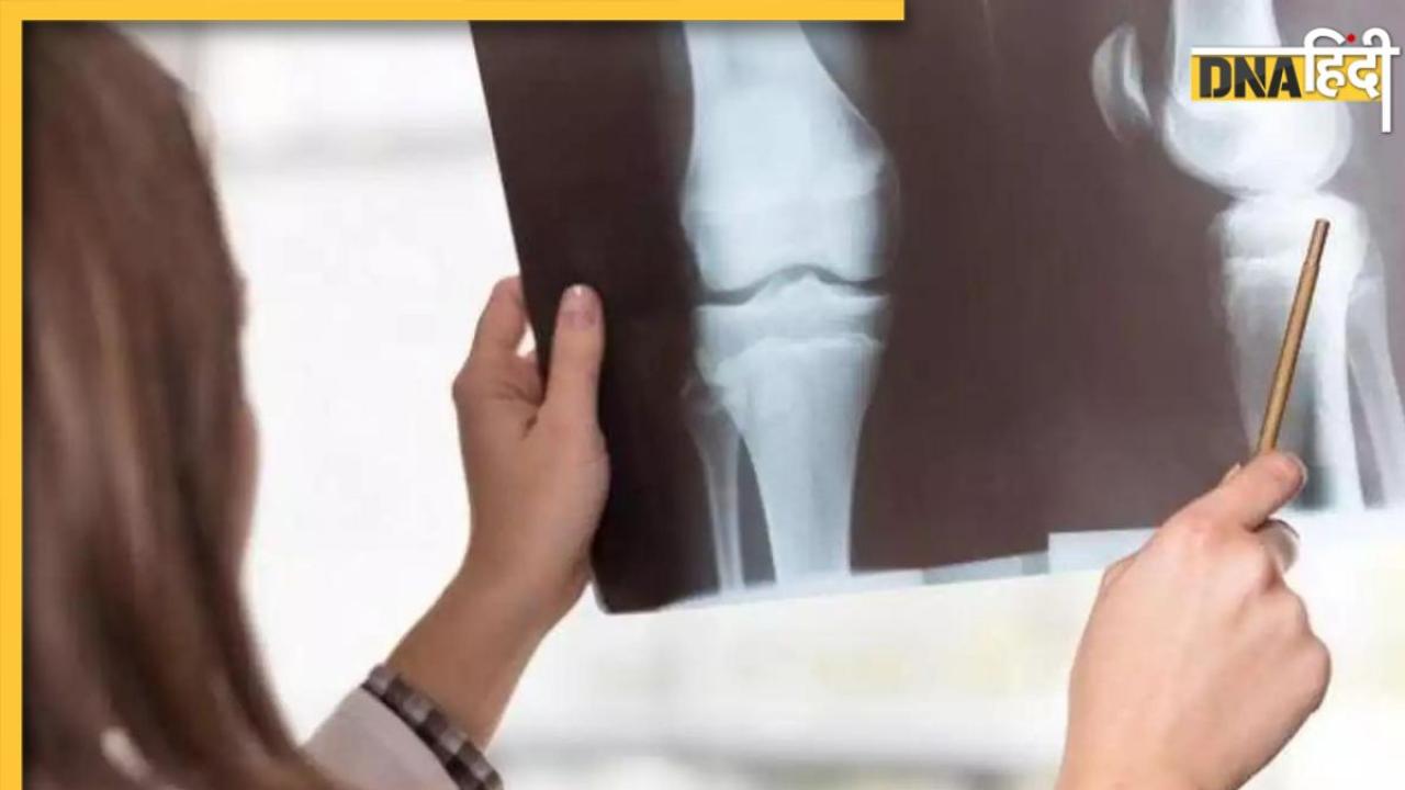 Weak Bones : हड्डियों पर जंक लगा रहा वायु प्रदूषण, ये 8 चीजें ज्वाइंट्स की जकड़न और कमजोरी करेंगी दूर 