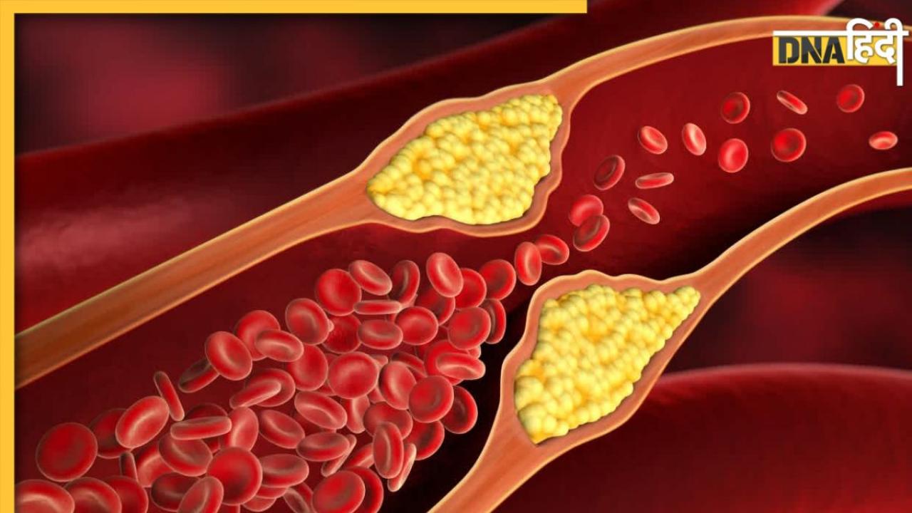 Reduce High Cholesterol: बैड कोलेस्ट्रॉल का काल है ये 5 हरे पत्ते, खाली पेट चबाने से बाहर होगा नसों में जमा गंदा कोलेस्ट्रॉल