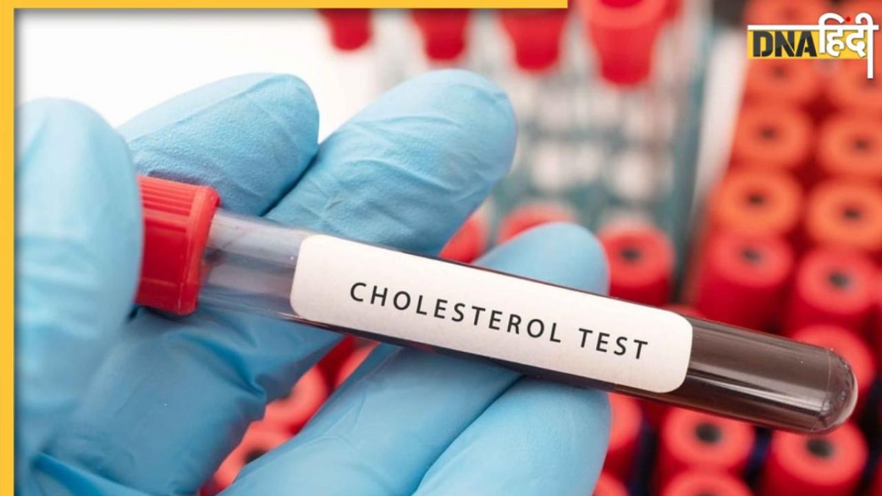 Cholesterol Test: कोलेस्ट्रॉल के लिए ब्लड टेस्ट कराने से पहले इन 5 बातों का रखें खास ध्यान, वरना कभी सही नहीं मिलेगा रिजल्ट