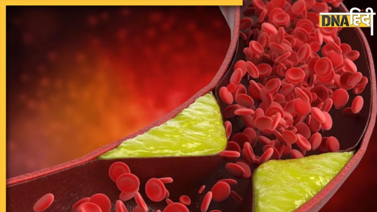 Cholesterol Remedy: शरीर में जमा गंदा कॉलेस्ट्रोल सोख लेते हैं ये 5 फूड्स, डाइट में जरूर करें शामिल