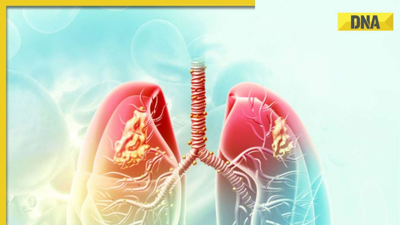 Lung Cancer Awareness Month: What is lung cleansing, why should you do it?