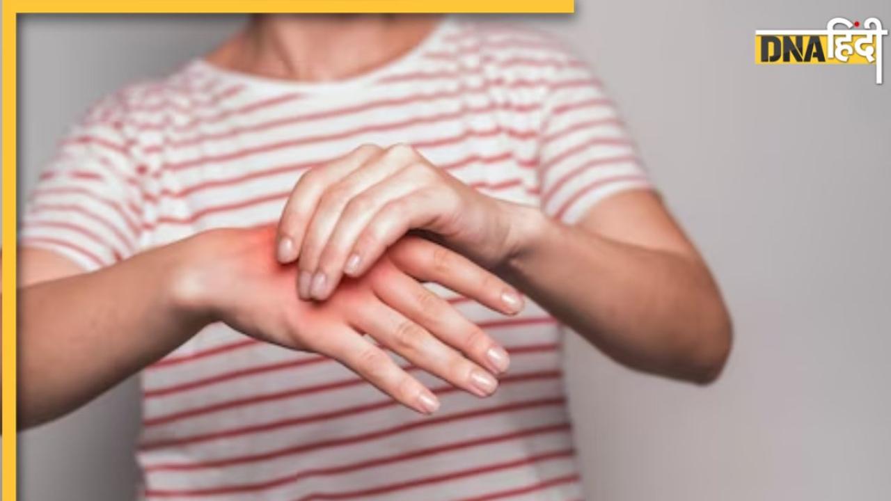 Arthritis Treatment: सर्दी में गठिया के मरीज इन खास बातों का रखें ध्यान, नहीं बढ़ेगा जोड़ों का दर्द