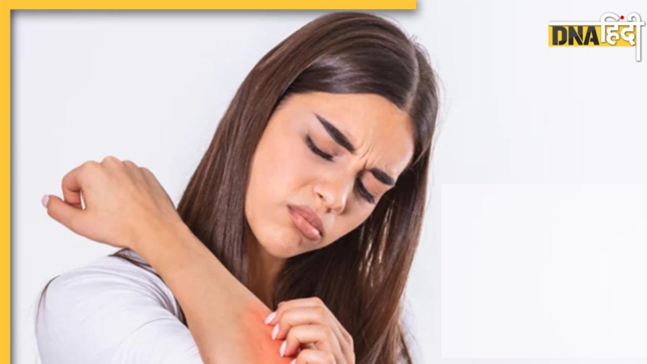 Skin Itching Remedies: सर्दियों में हाथ-पैरों की खुजली और स्किन रेडनेस से हैं परेशान, इन 4 घरेलू उपायों से मिलेगा आराम