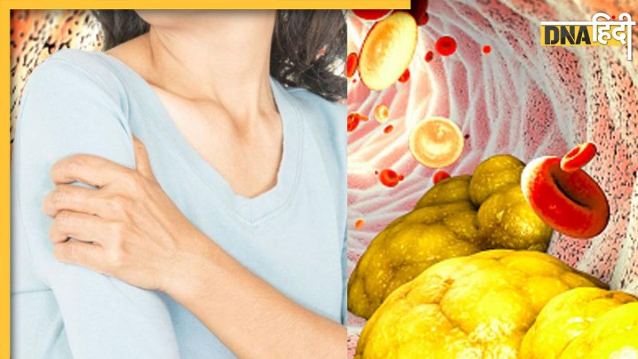 High Cholesterol का संकेत हो सकता है शरीर के इन 5 हिस्सों में होने वाला दर्द, अनदेखी पड़ सकती है भारी