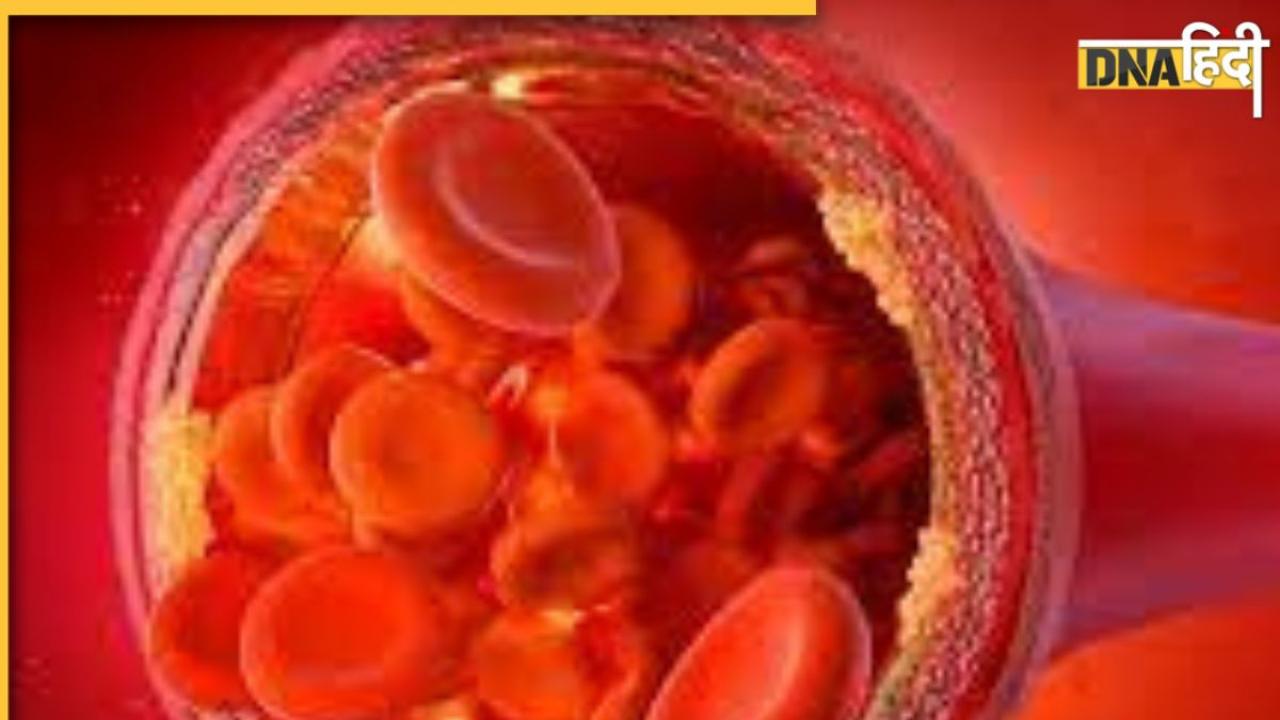 Good Cholesterol Risk: आंख बंद कर न बढ़ाएं गुड कोलेस्ट्रॉल, बहुत अधिक एचडीएल भी हार्ट-लिवर कर सकता है फेल