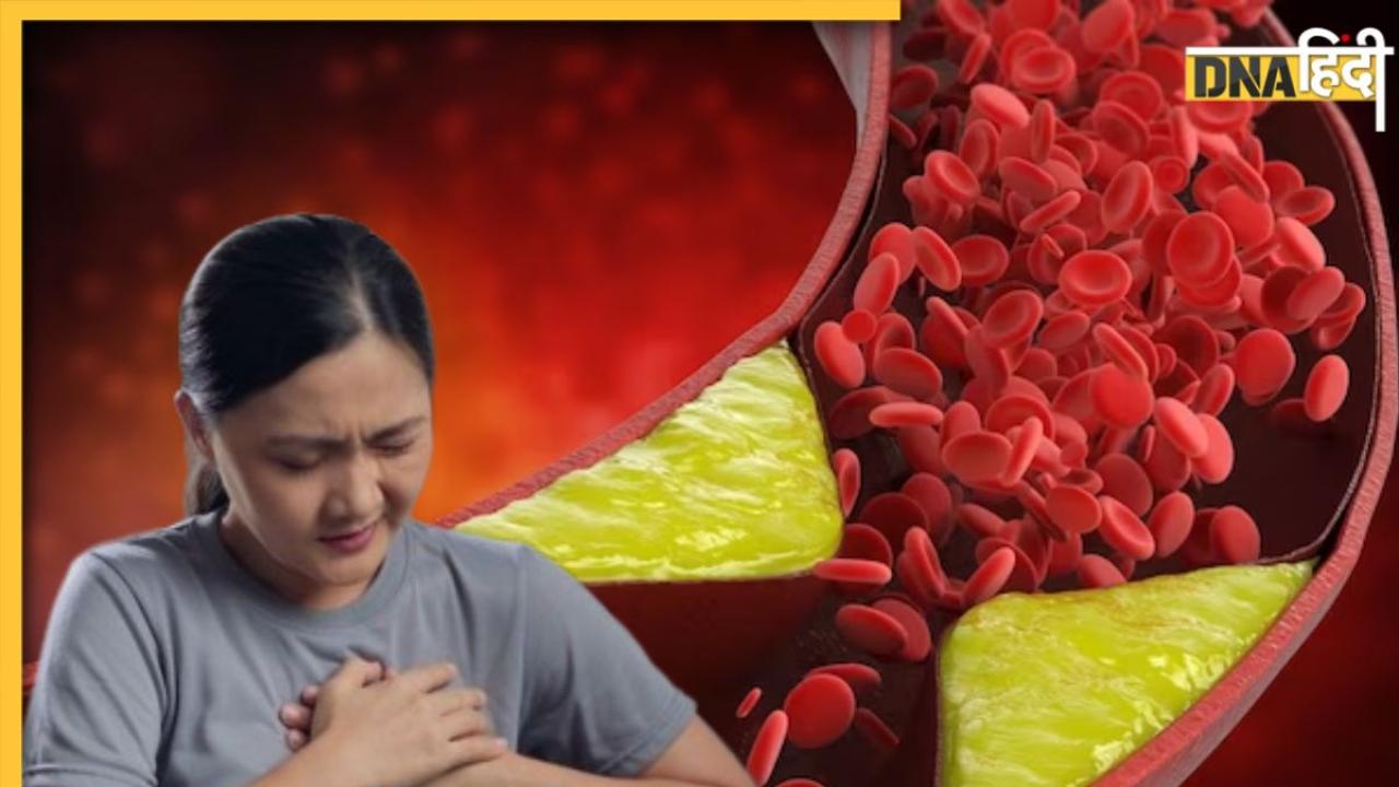 Cholesterol Remedy: बिना दवा ये 5 चीजें नसों में जमा गंदा कोलेस्ट्रॉल कर देंगी बाहर, डाइट में जरूर करें शामिल 