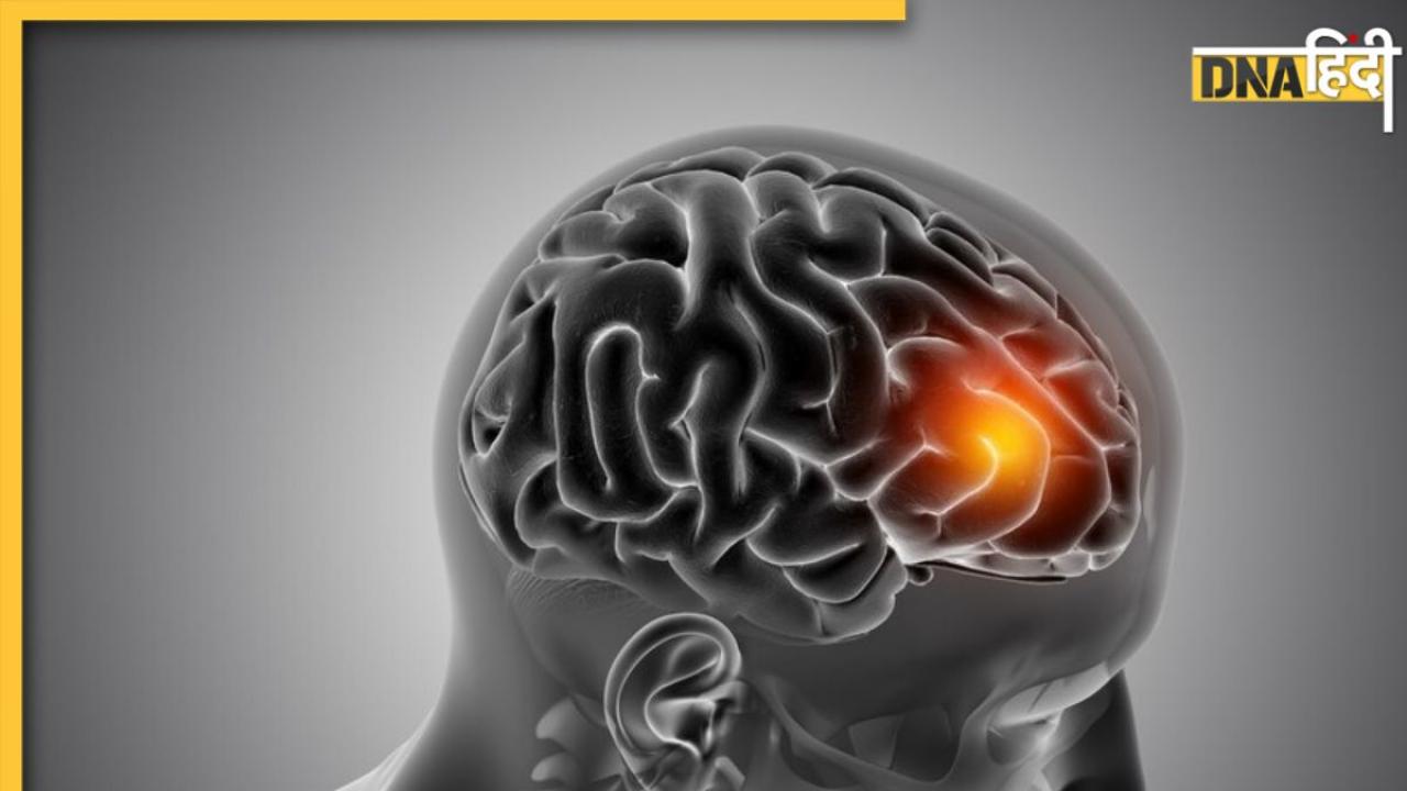 Brain Stroke Risk: ये 5 गलत आदतें बढ़ाती हैं ब्रेन स्ट्रोक-हाई बीपी का खतरा, तुरंत बदलें वरना जा सकती है जान