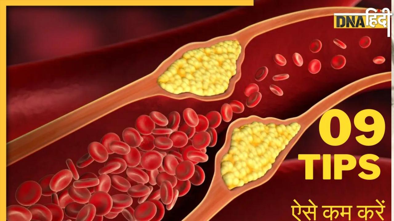 High Cholesterol को कंट्रोल करें महज 5 दिन में, आयुर्वेदिक डॉक्टर ने बताए 10 नुस्खे