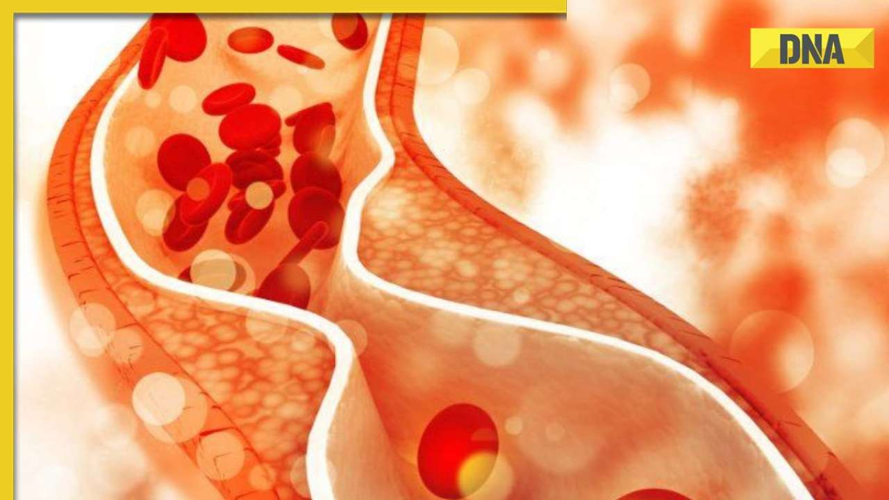 How bad cholesterol increases risk of heart disease? Way to bring it down naturally
