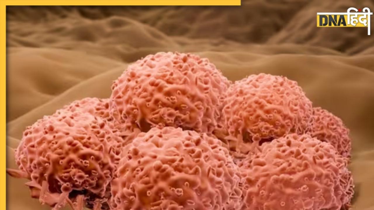 Rare Cancer: हाथ-पैर और मांसपेशियों में लगातार दर्द इस खतरनाक कैंसर का हो सकता है संकेत, न करें अनदेखा 