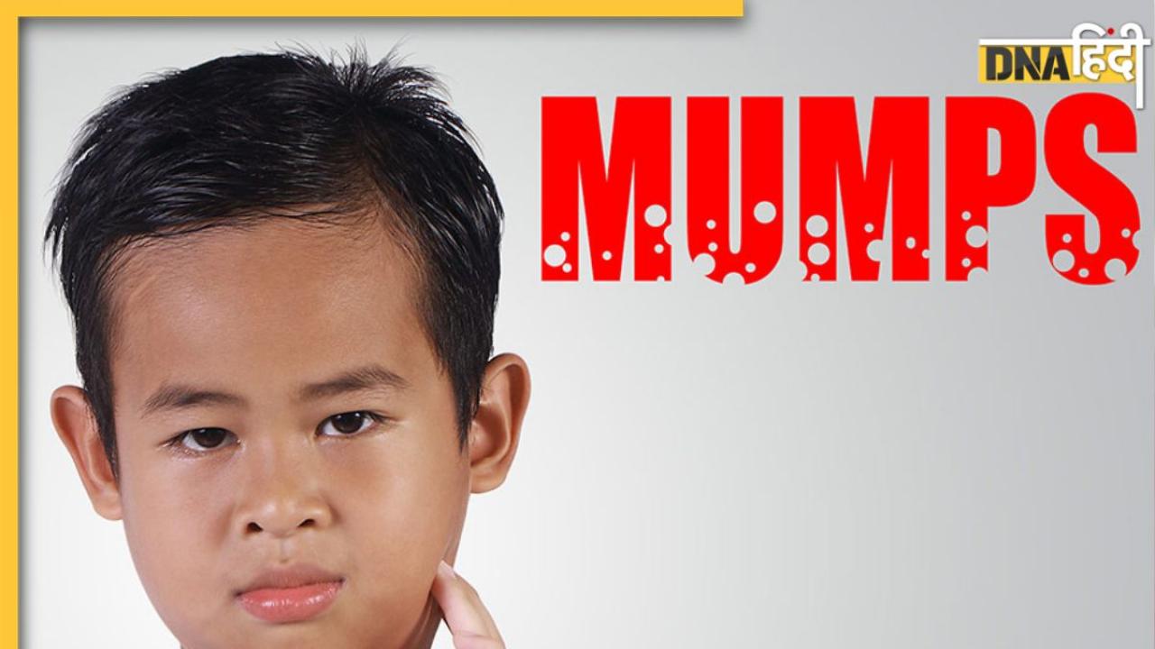 Mumps Virus Attack: तेजी से फैल रहा बच्चों में मम्प्स वायरस, जान लें लक्षण और बचाव का आसान तरीका