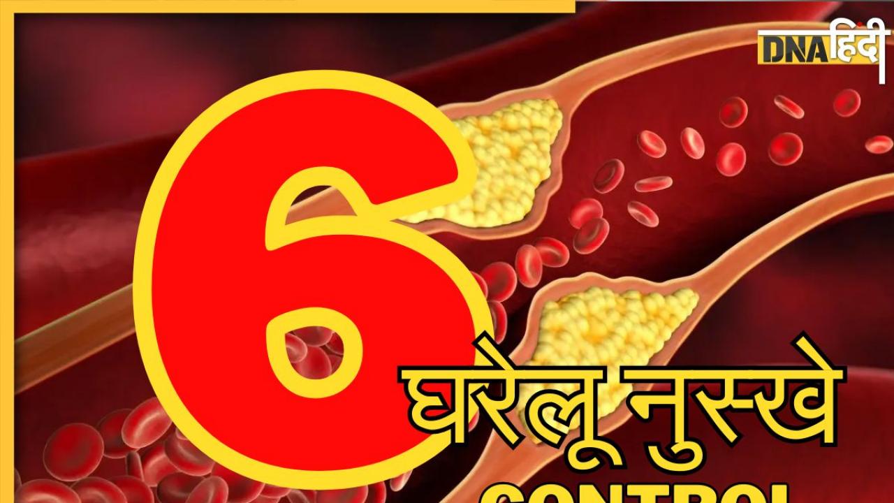 Cholesterol Control Remedy: कोलेस्ट्रॉल के छक्के छुड़ा देंगी आपकी ये 6 आदतें