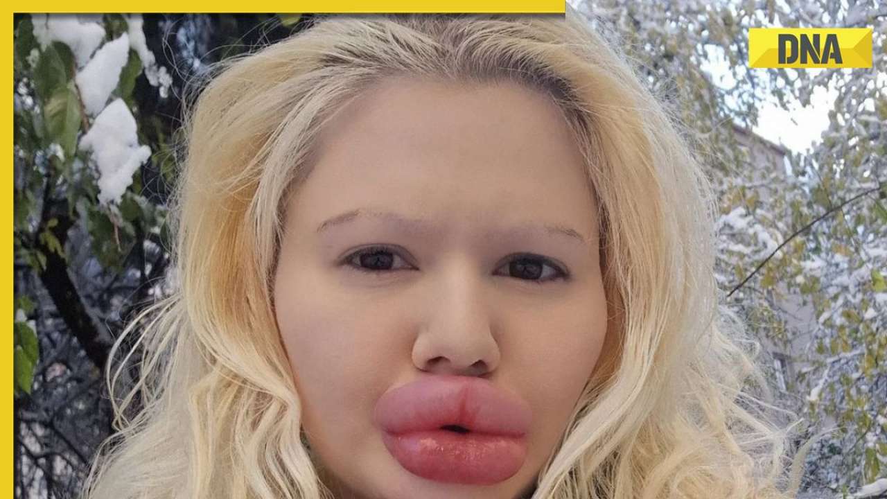 Meet woman with 'world's biggest' lips, she is not done yet, now plans to...