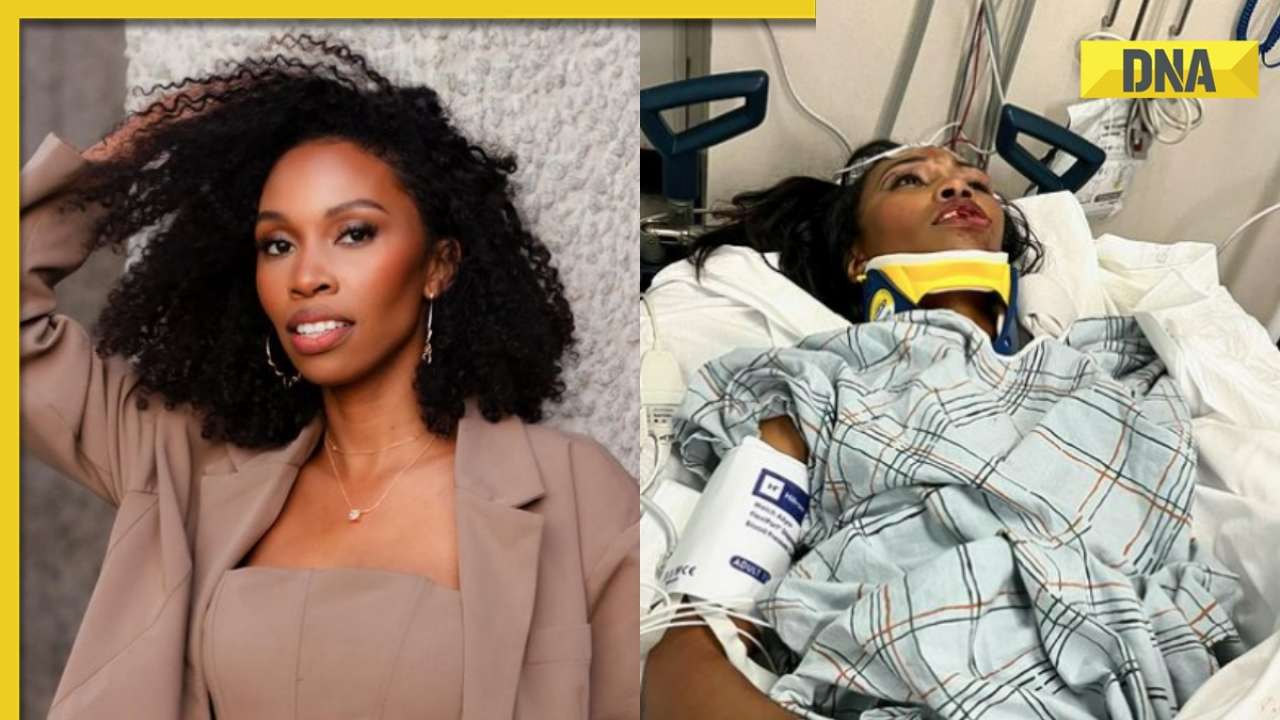 Black Panther actor Carrie Bernans injured in hit-and-run, mother shares pics: 'Broken bones, fractures, chipped teeth'
