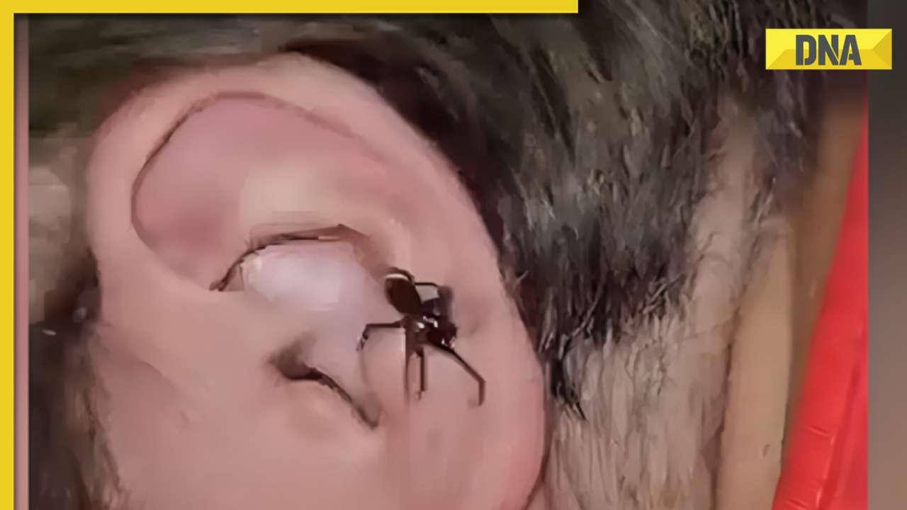Spider emerges from man's ear in terrifying viral video, internet is scared