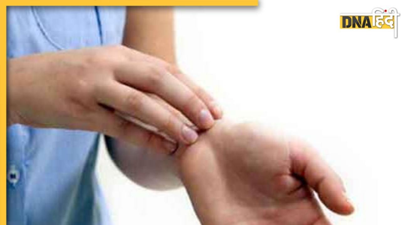 Itching Remedies: सर्दियों में हाथ-पैरों में होने वाली खुजली को ऐसे करें दूर, अपनाएं ये असरदार घरेलू नुस्खे