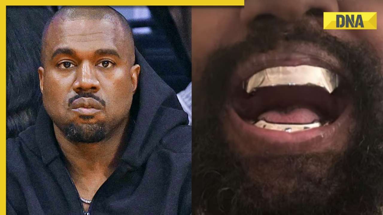 'Too much money': Kanye West replaces his teeth with Rs 7 crore titanium dentures, gets trolled