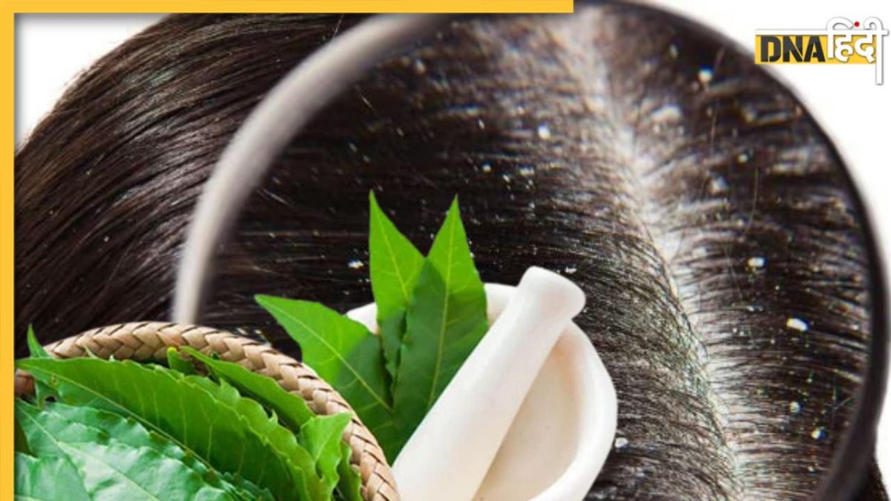 Dandruff Remedies: मिल गया डैंड्रफ का रामबाण इलाज, 4 तरह से इस्तेमाल करें नीम की पत्तियां, कभी नहीं होगी रूसी