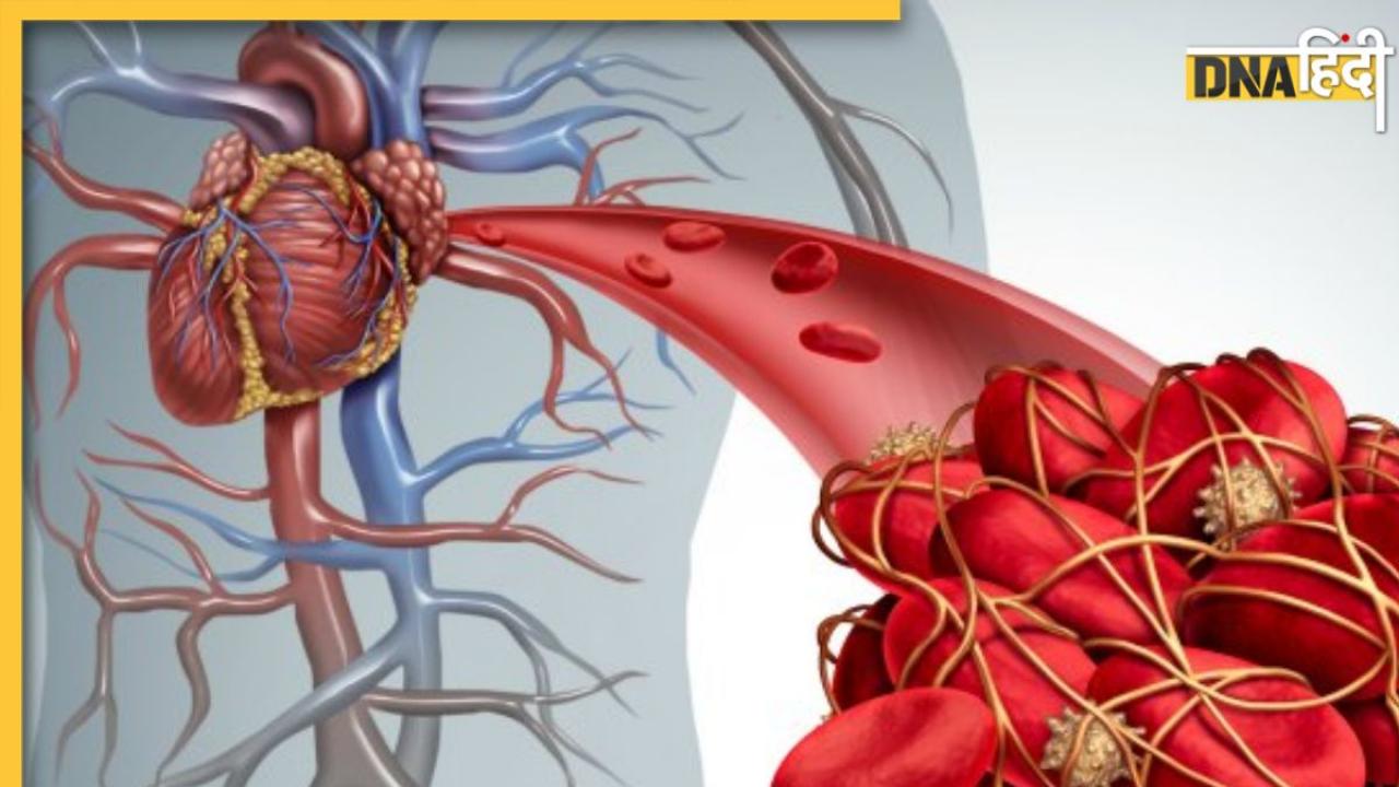 Blood Clot Risk: ठंड में नसों में क्यों जम जाते हैं खून के थक्के? जानें क्या है इसका कारण, लक्षण और बचाव के उपाय