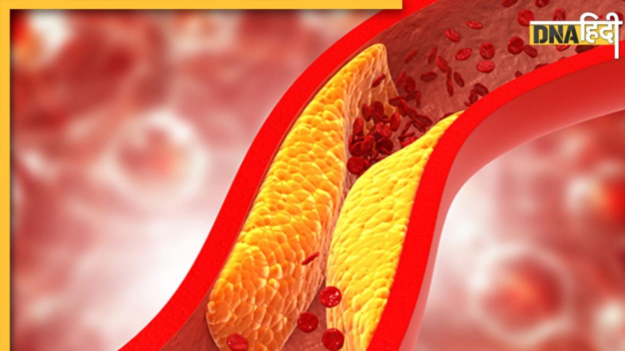 Cholesterol Treatment: शरीर के इन अंगों को भयंकर नुकसान पहुंचाता है बढ़ा हुआ कोलेस्ट्रॉल, अनदेखा करना पड़ सकता है भारी