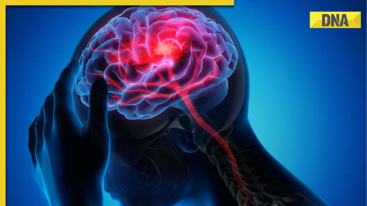 Ischemic Stroke: Know causes, symptoms and precautions of the condition here