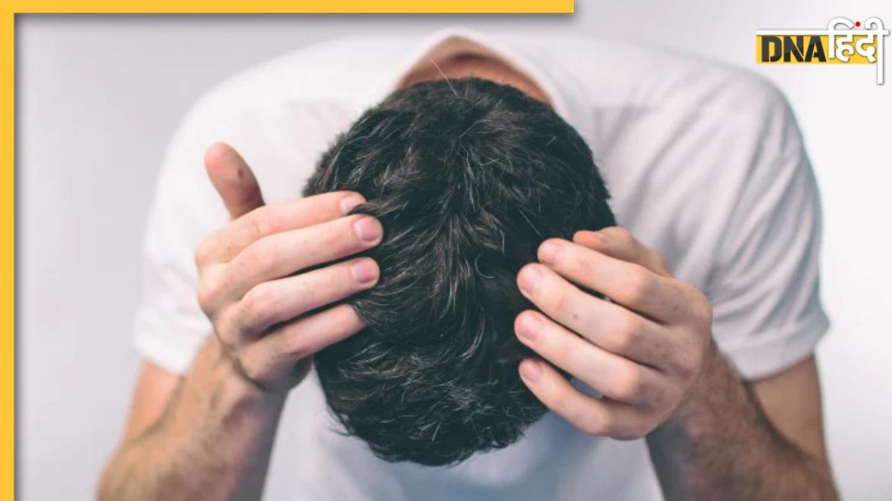 Dandruff Remedies: डैंड्रफ हटाने के लिए अपनाएं ये कमाल का नुस्खा, नारियल तेल से होगा रूसी का सफाया