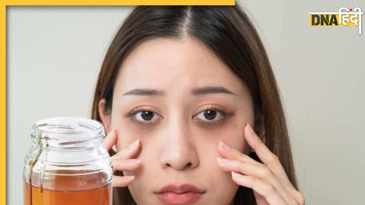 Dark Circles को दूर कर सकता है शहद का इस्तेमाल, इस तरह यूज करने से मिलेगा फायदा