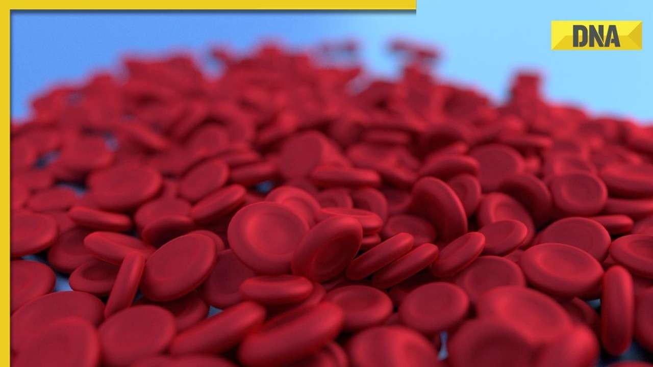 鎌状赤血球貧血がある場合に注意すべき脳卒中の症状は何ですか?