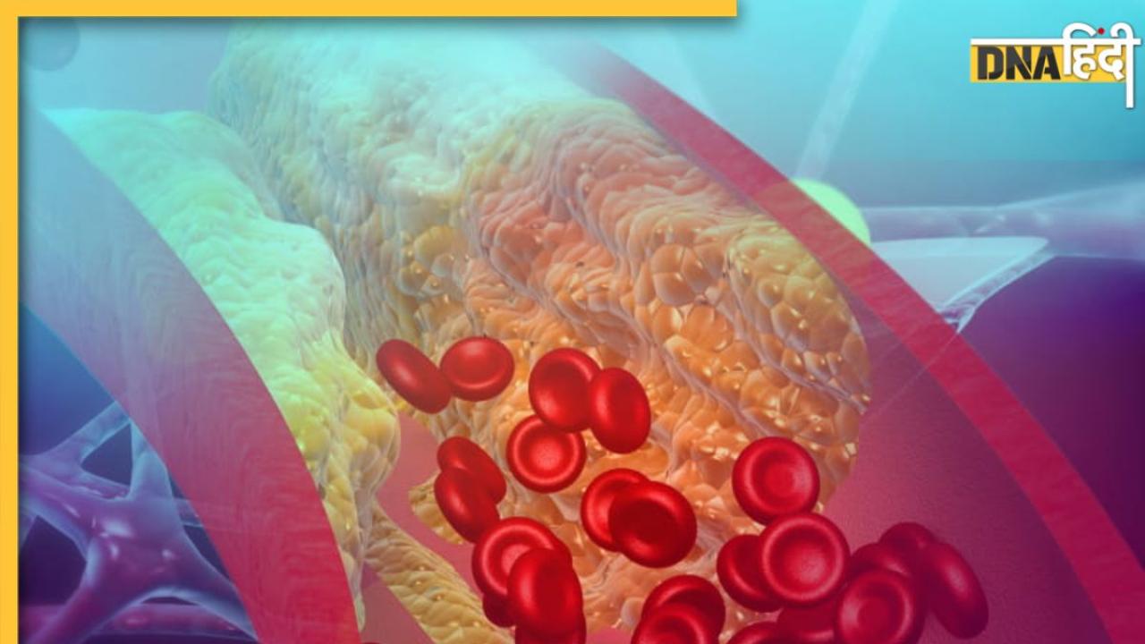 रसोई में रखी 2 खट्टी-मीठी चीजें खाने से खत्म होगा Bad Cholesterol, दूर होगी नसों की ब्लॉकेज