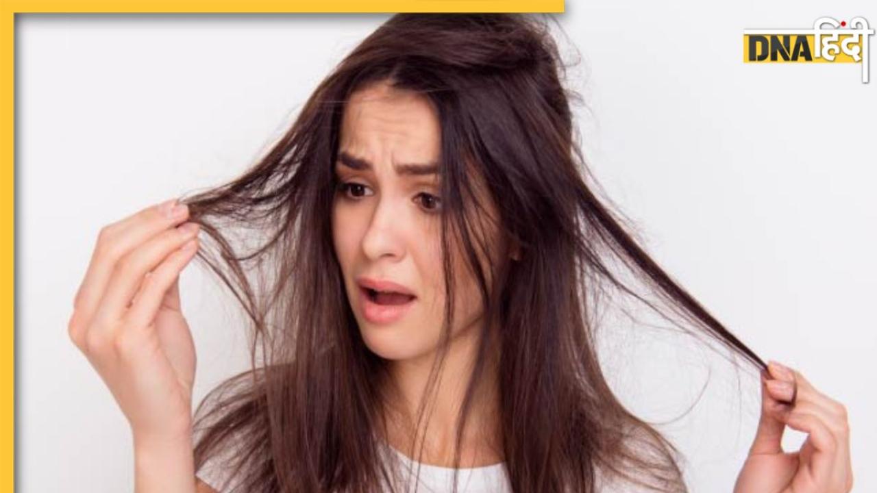 Hair Loss Control: झड़ते बालों की समस्या को और बढ़ा देंगी ये 5 चीजें, दवा का भी नहीं होगा असर