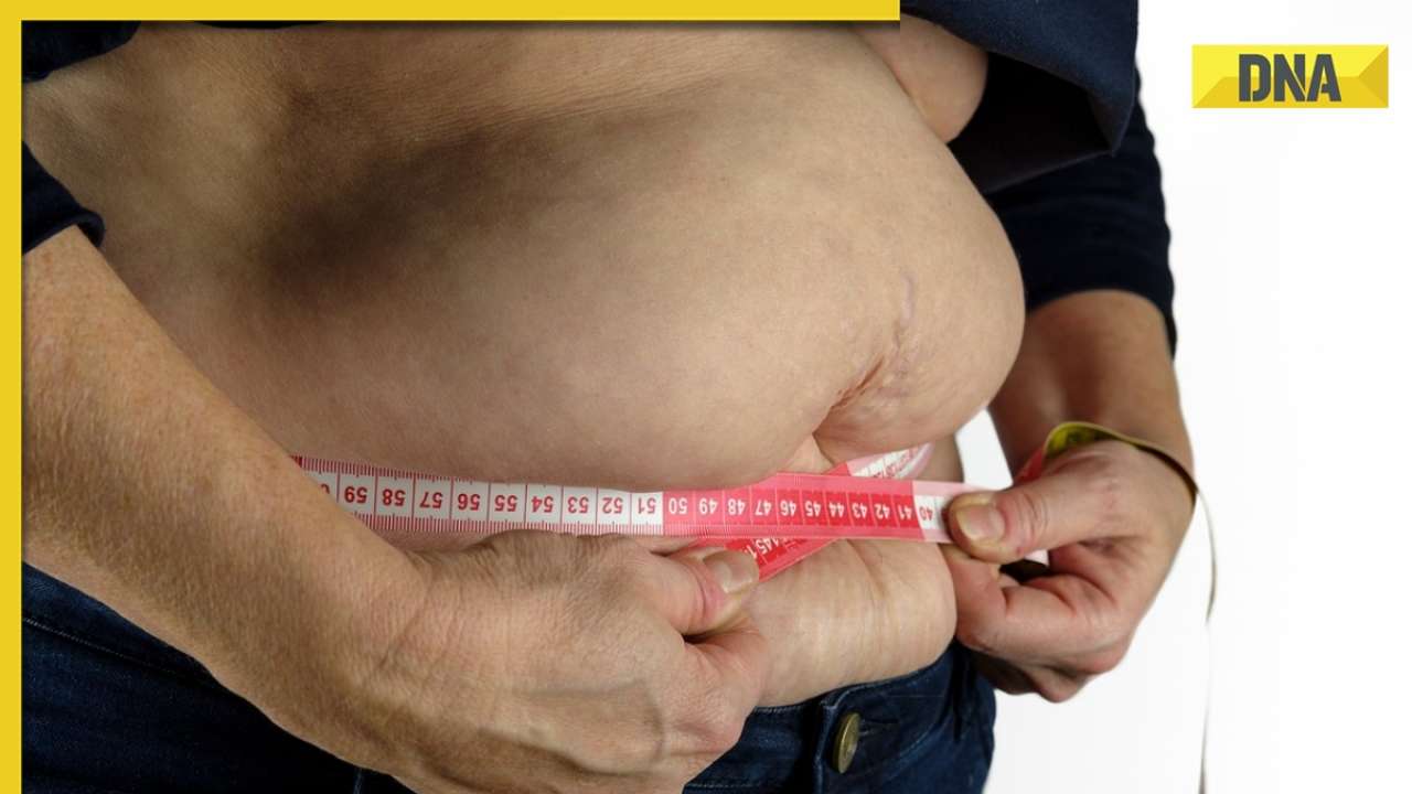 100 crore people in world now obese, 4 times increase in 30 years: Lancet report
