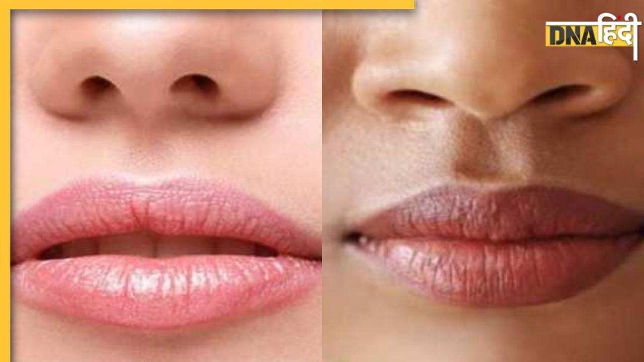 होठों का रंग पड़ गया है काला तो इन तरीकों से पाएं Natural Pink Lips, गुलाबी और चमकदार बनेंगे होंठ