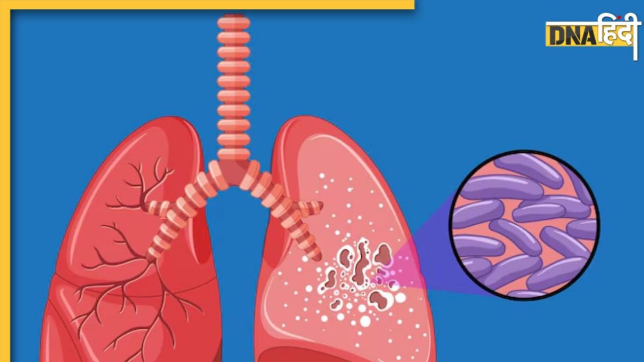 World TB Day 2024: शरीर में दिखने वाले ये सामान्य लक्षण हो सकते हैं टीबी के संकेत, 'STOP' टेक्नीक से करें बचाव