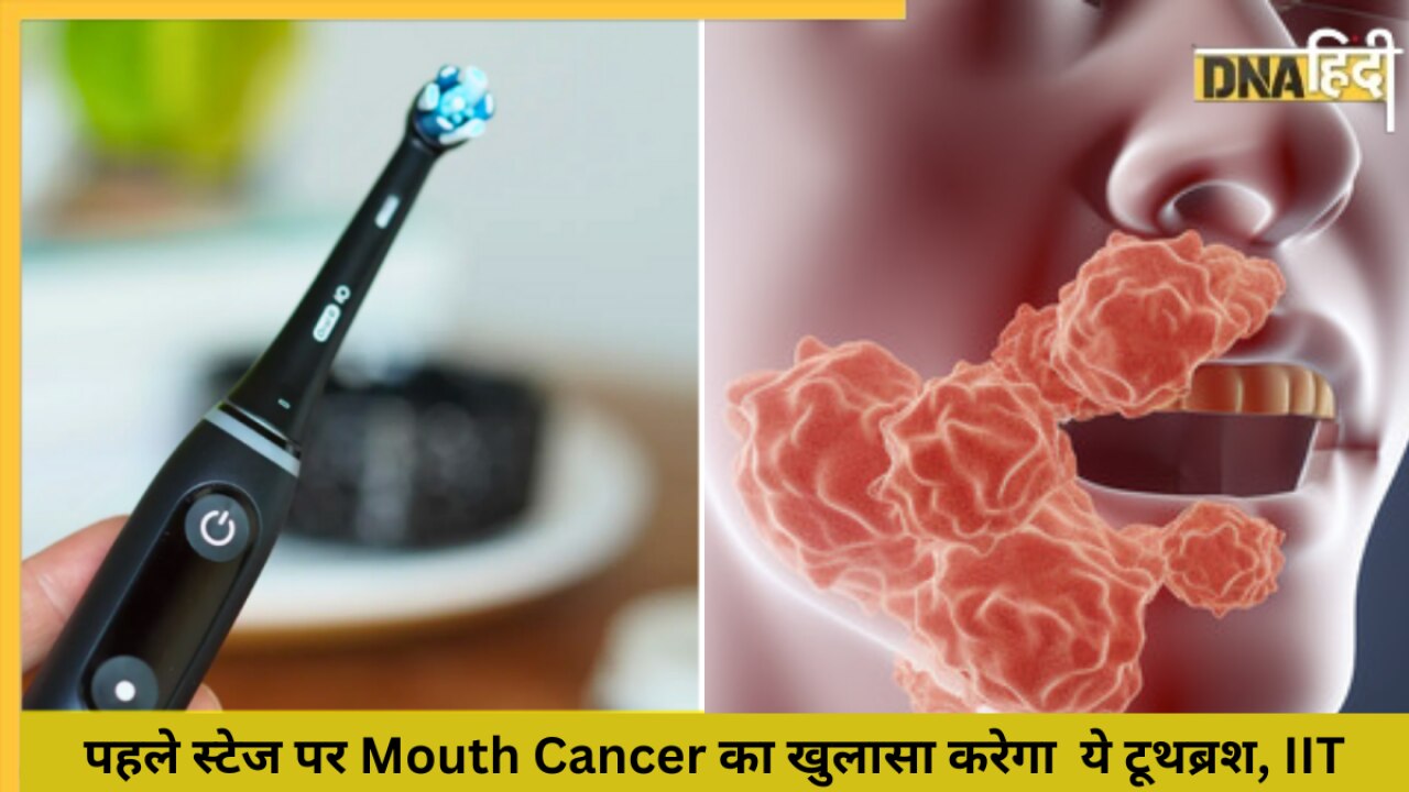 पहले स्टेज पर Mouth Cancer का खुलासा करेगा ये टूथब्रश, IIT Kanpur ने किया कमाल 