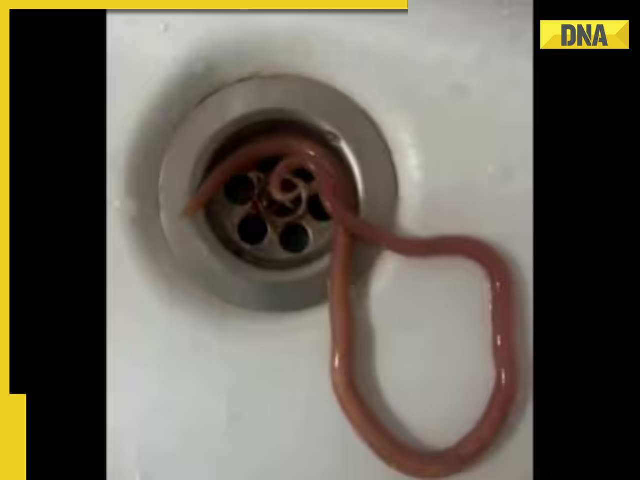 Viral video: Man vomits live worm following complaints of nausea, details here