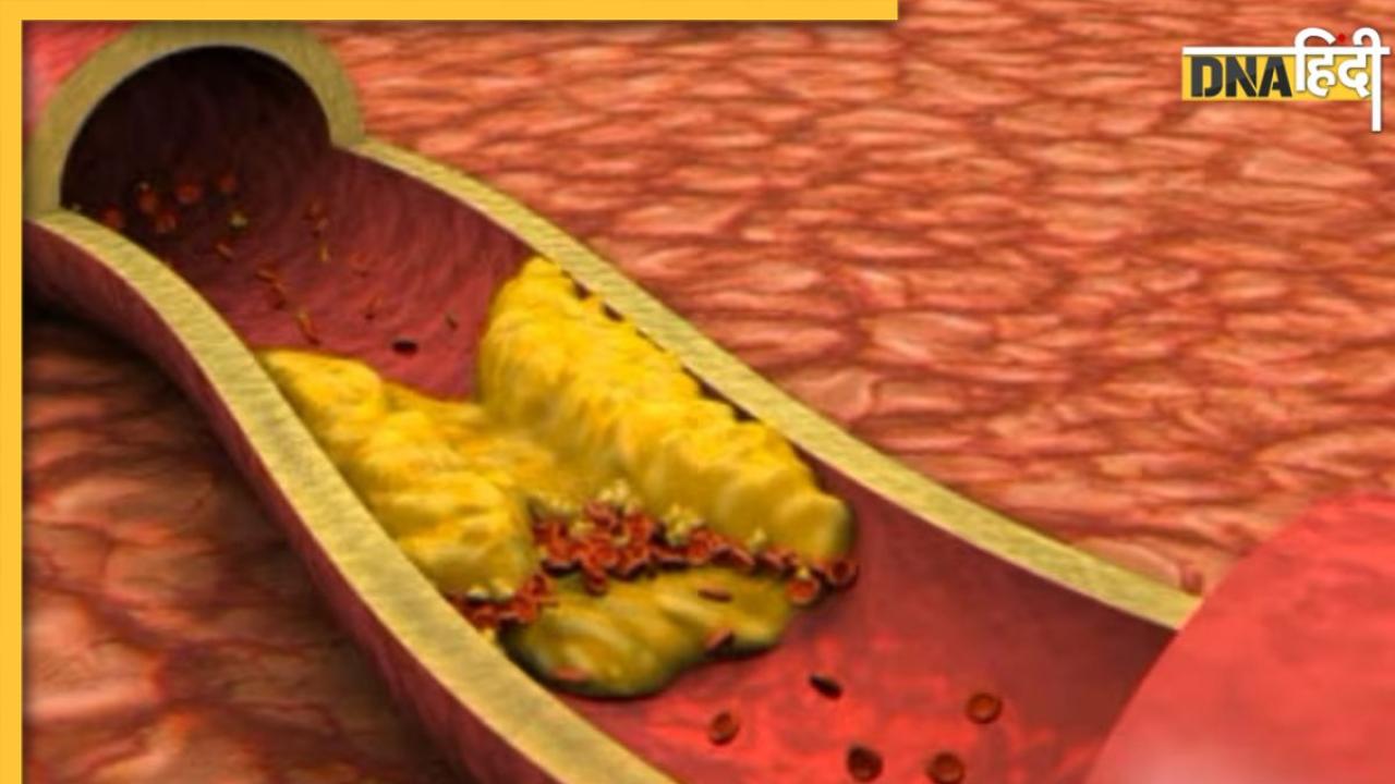 Bad Cholesterol Control: खराब कोलेस्ट्रॉल कम करने के लिए हर दिन करें ये 7 काम, धमनियों से निकलती जाएगी चर्बी