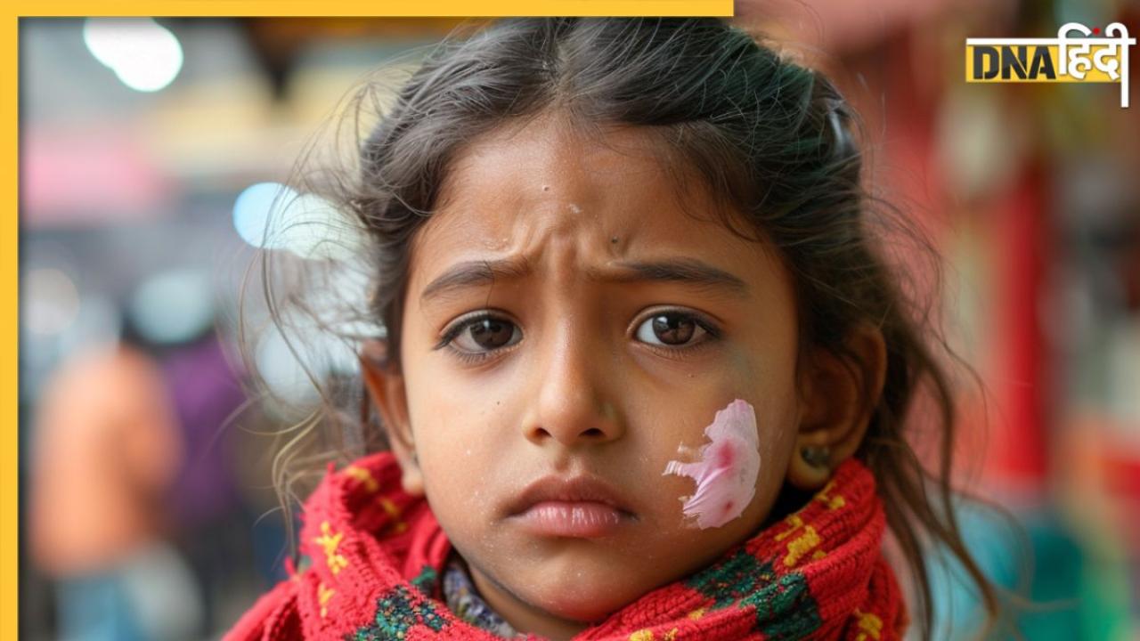 Delhi NCR में बच्चे हो रहे इस गंभीर बीमारी के शिकार, ये लक्षण दिखें तो तुरंत हो जाएं अलर्ट