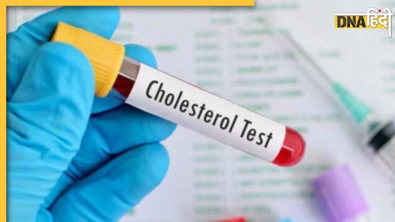 Cholesterol Test कराने से पहले भूलकर भी न करें ये काम, वरना सही नहीं आएगा रिजल्ट