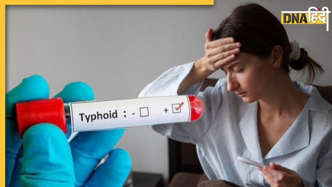 Typhoid Fever में दवा के साथ एक्स्ट्रा केयर भी है जरूरी, इन घरेलू उपायों से मिलेगी राहत