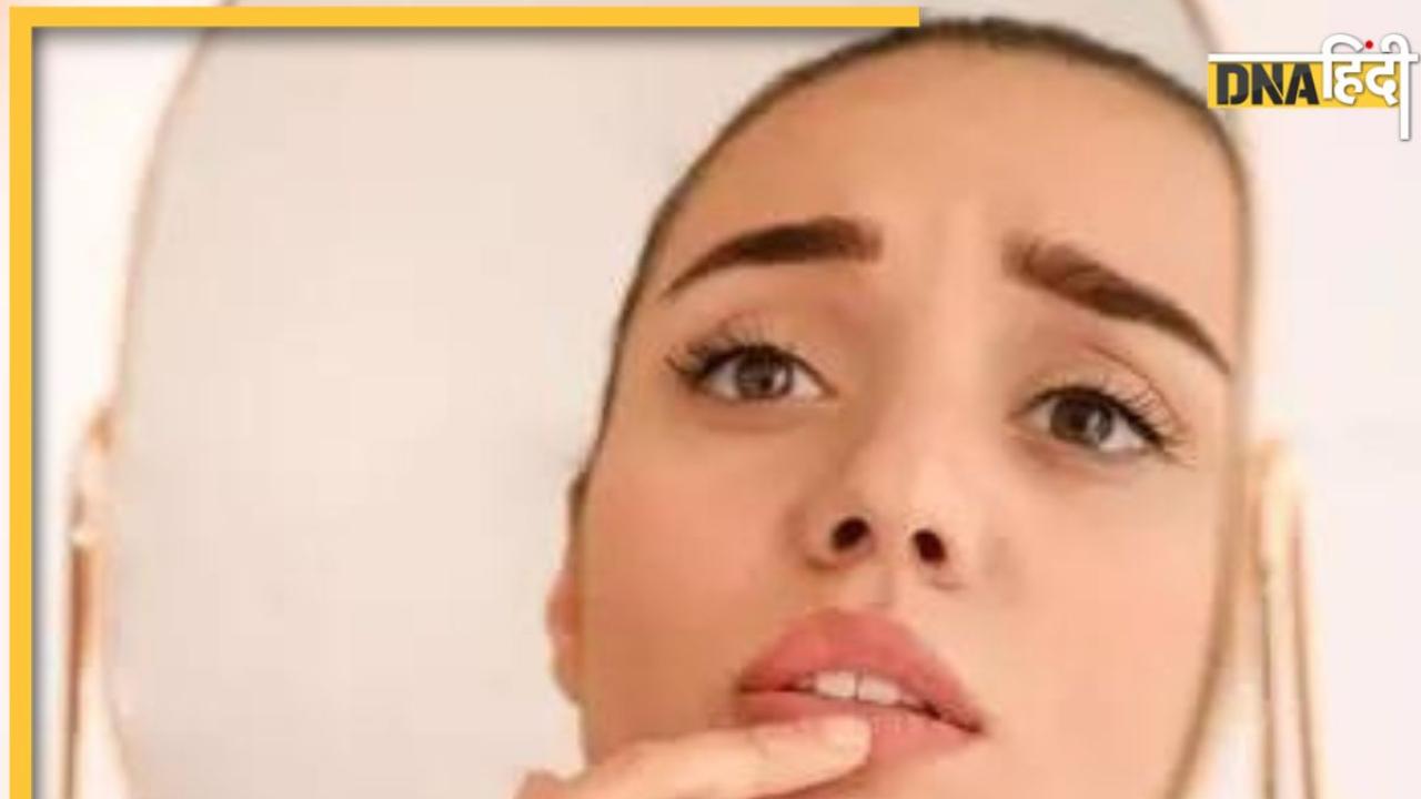 Swelling on Lips: मुंह और होठों में सूजन, मसूड़े में घाव या गले में कुछ फंसने जैसा महसूस होना जानलेवा भी हो सकता है