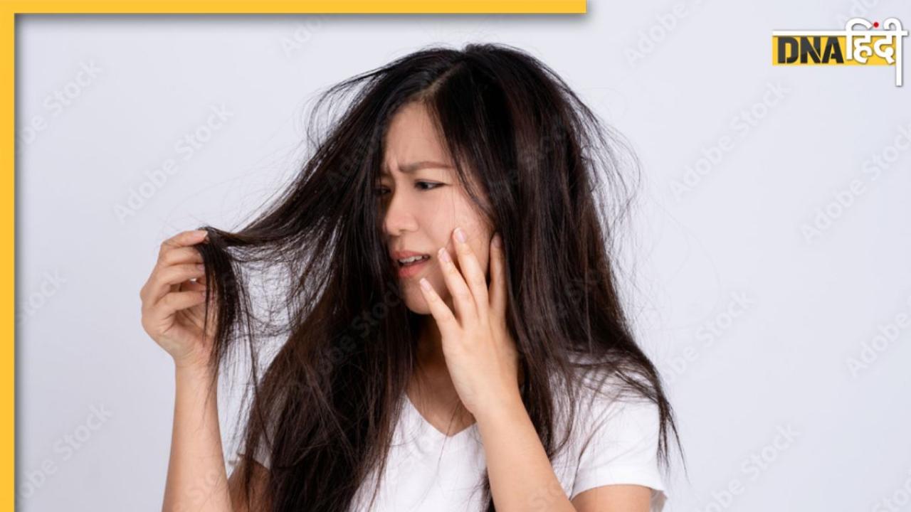 What Causes Fatigue-Hair fall: बालों का अत्यधिक झड़ना और थकान होना इस पोषक तत्व की भयंकर कमी का है संकेत