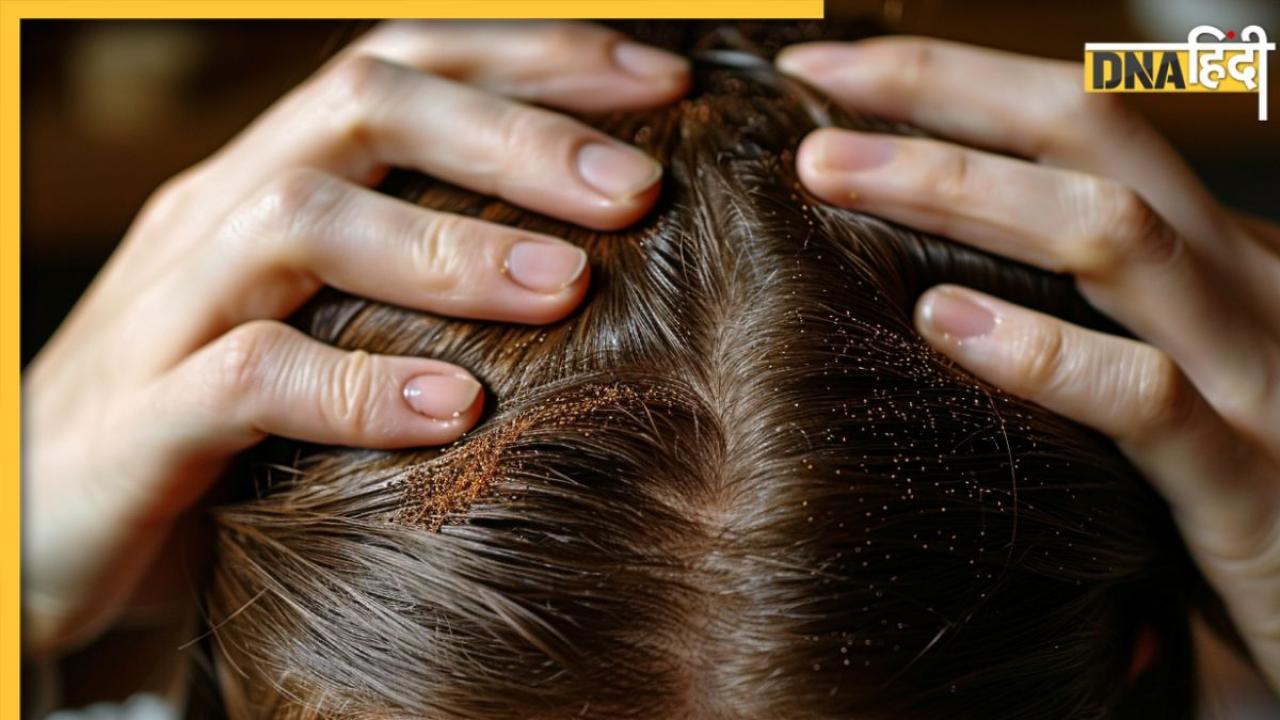 बालों के झड़ने से परेशान तो इस्तेमाल करें दही और कॉफी हेयर मास्क, दूर होगी Hair Fall की समस्या